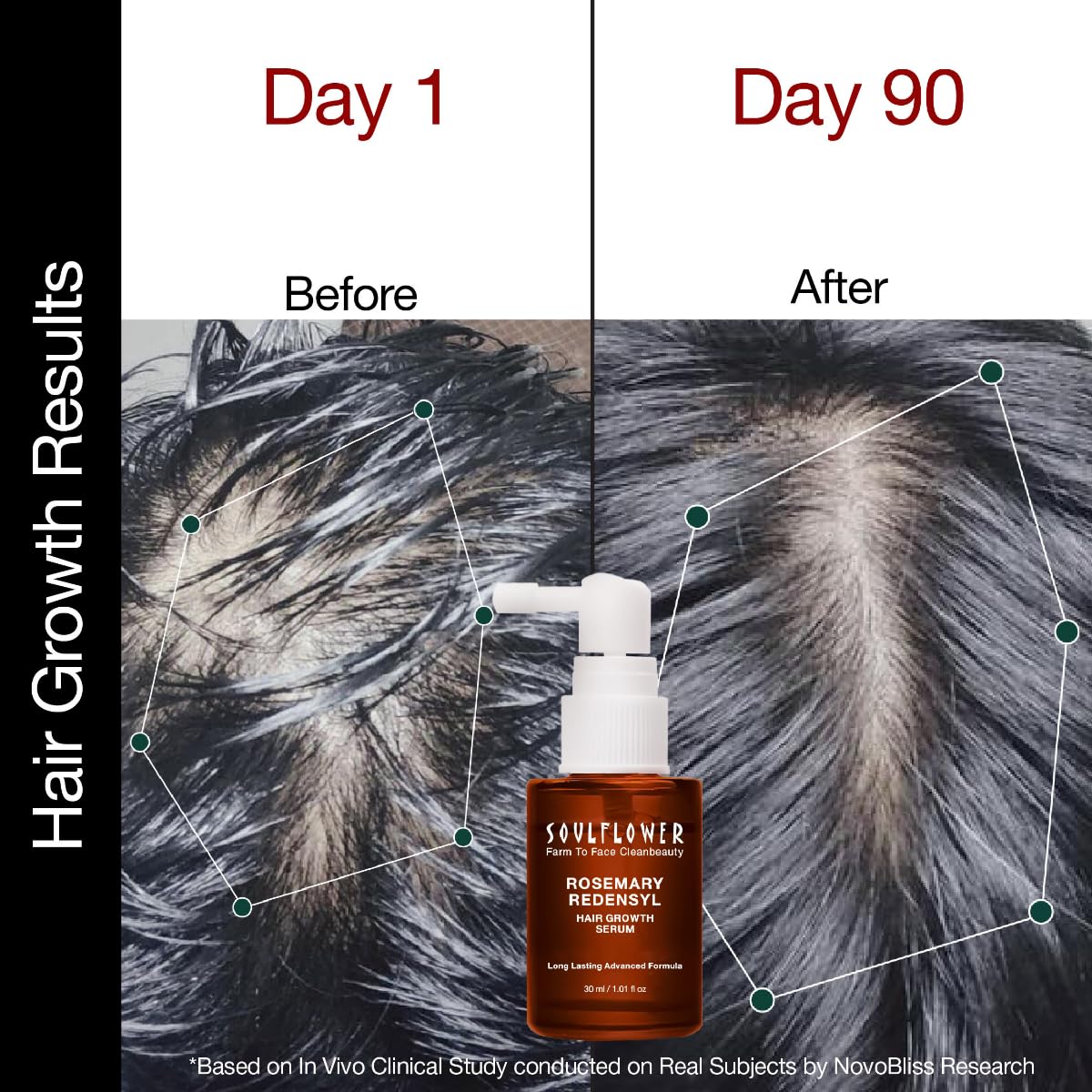 Soulflower Hair Growth Serum, Rosemary Oil, 3% Redensyl, 4% Anagain - Image 6