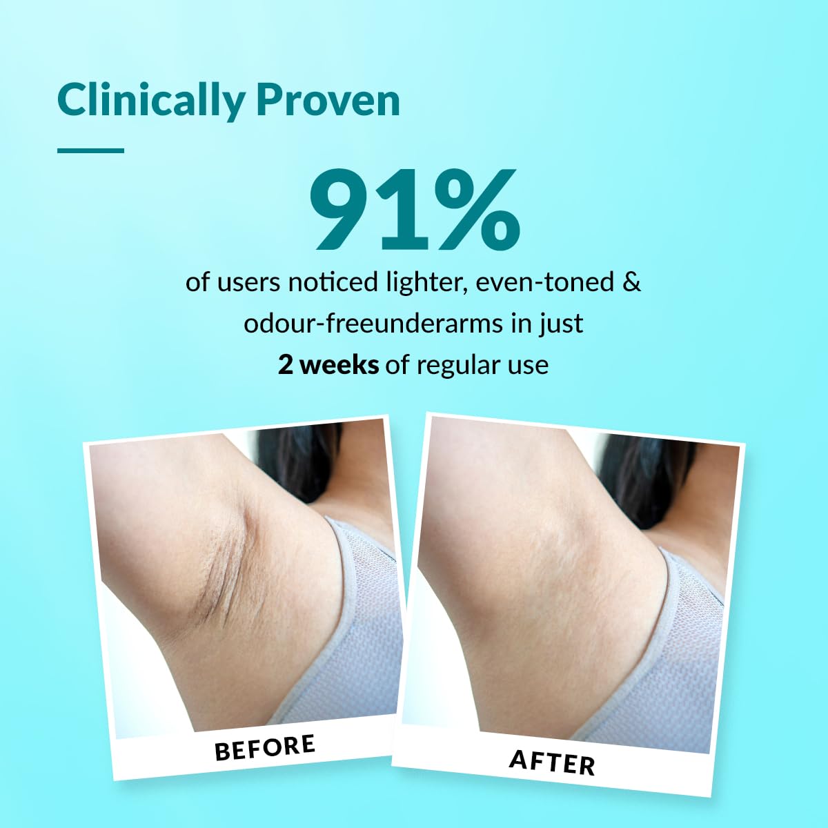 Fixderma Nigrifix Underarm Ocean Roll on With 6% AHA, Lactic Acid & 1% Mandelic Acid & Kojic Acid ensitive Skin - 60ml (Pack of 1) - Image 6