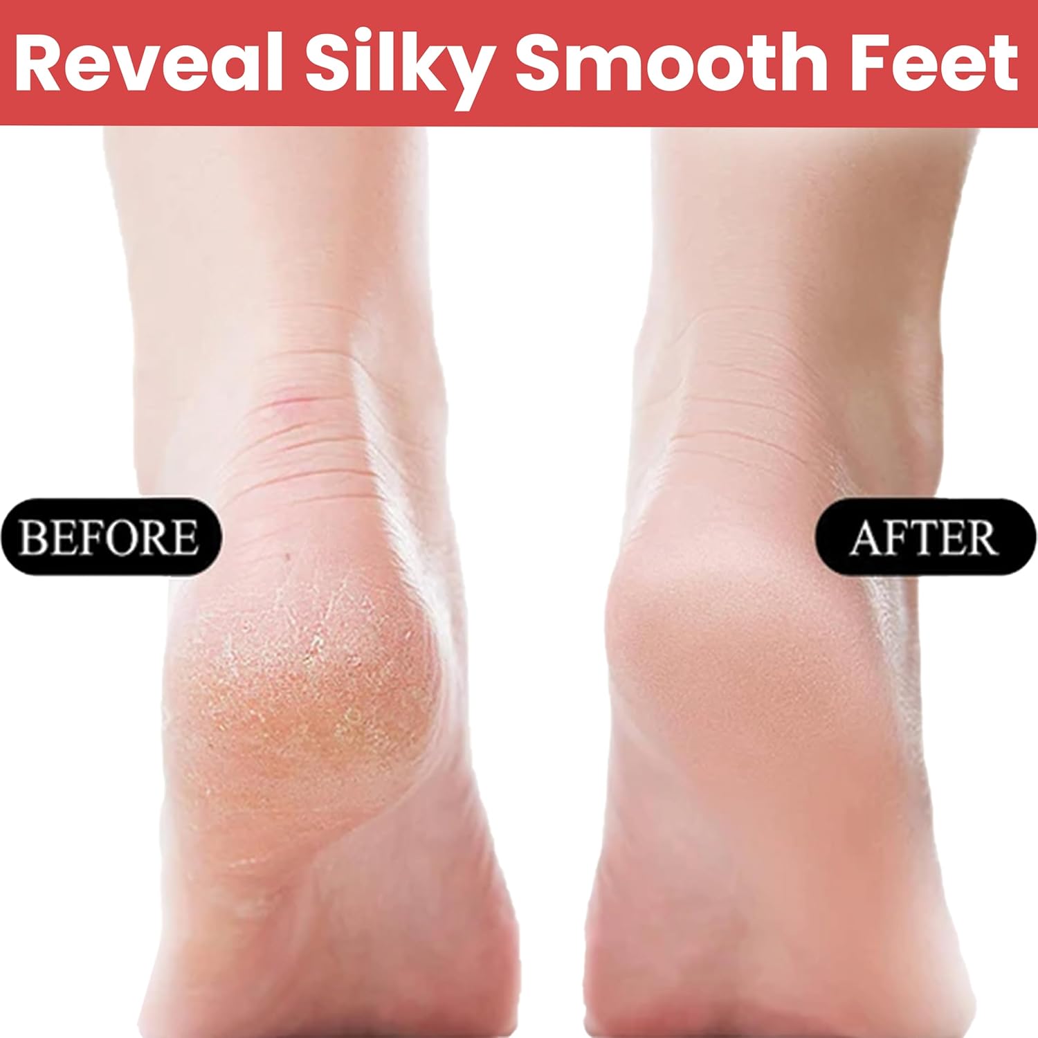 Temperia Leg, Heel & Foot Scrubber for Dead Skin - Very Sharp & Big - Image 3