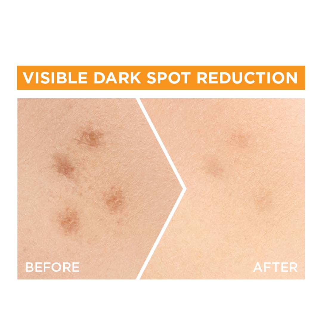 Garnier Bright Complete VITAMIN C Booster Face Serum, 30ml - Image 4